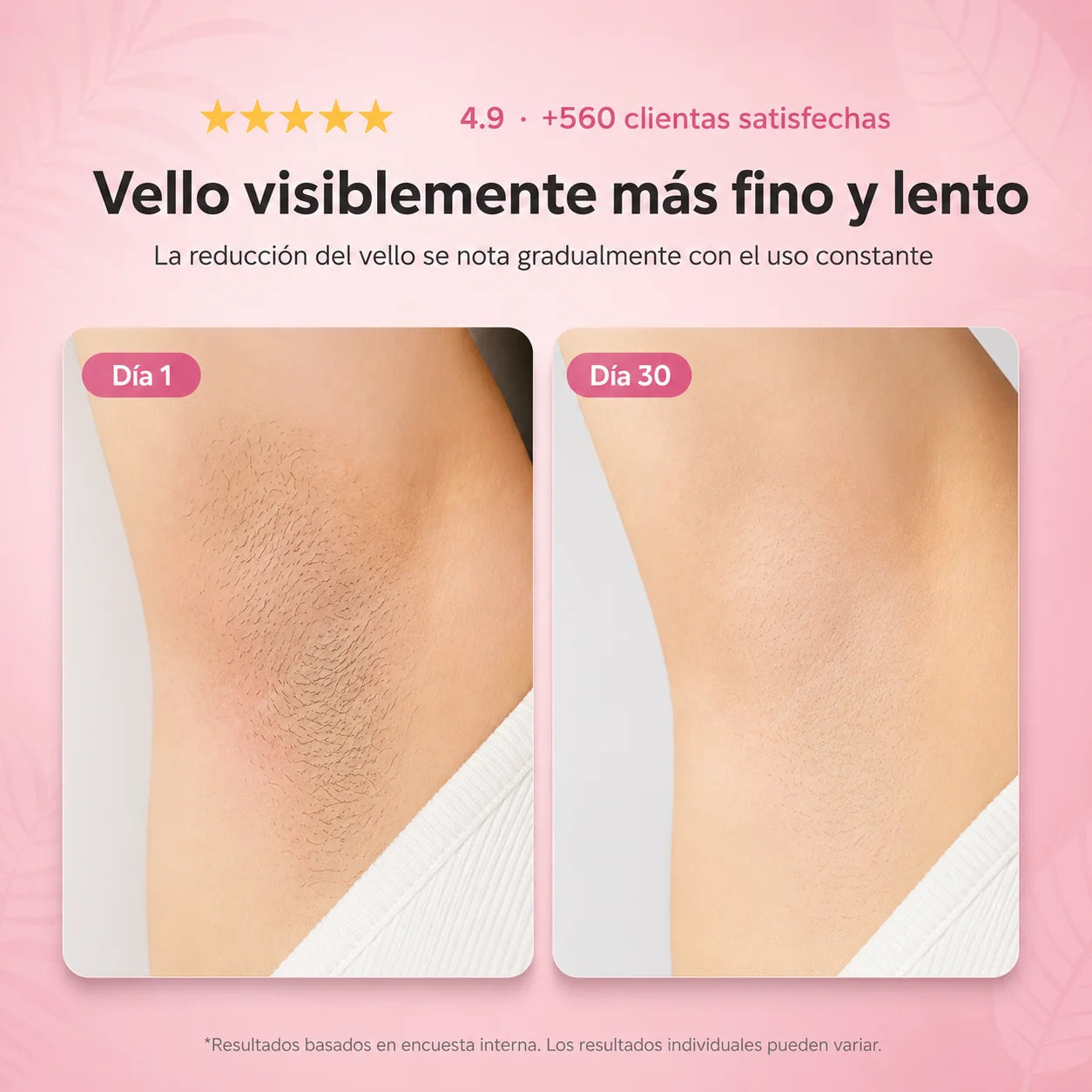 CYPERUS® - Piel sin Vellos y Manchas
