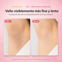 CYPERUS® - Piel sin Vellos y Manchas