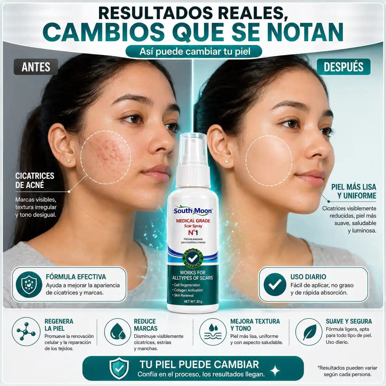 SOUTH MOON® - Spray para cicatrices
