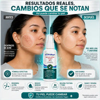 SOUTH MOON® - Spray para cicatrices