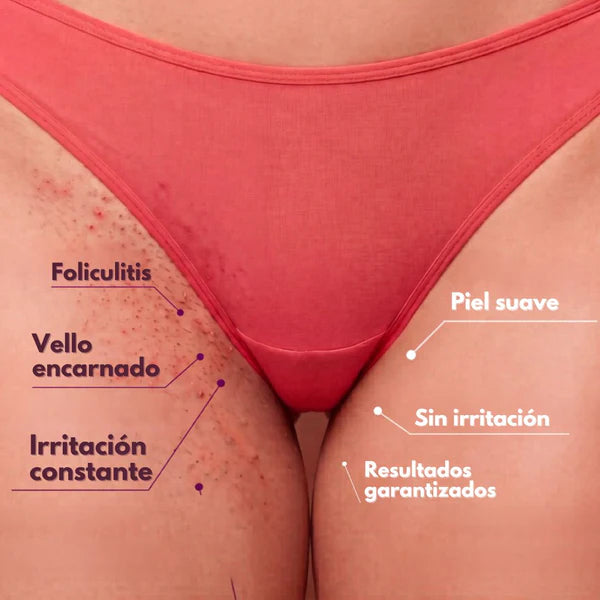 CYPERUS® - Piel sin Vellos y Manchas