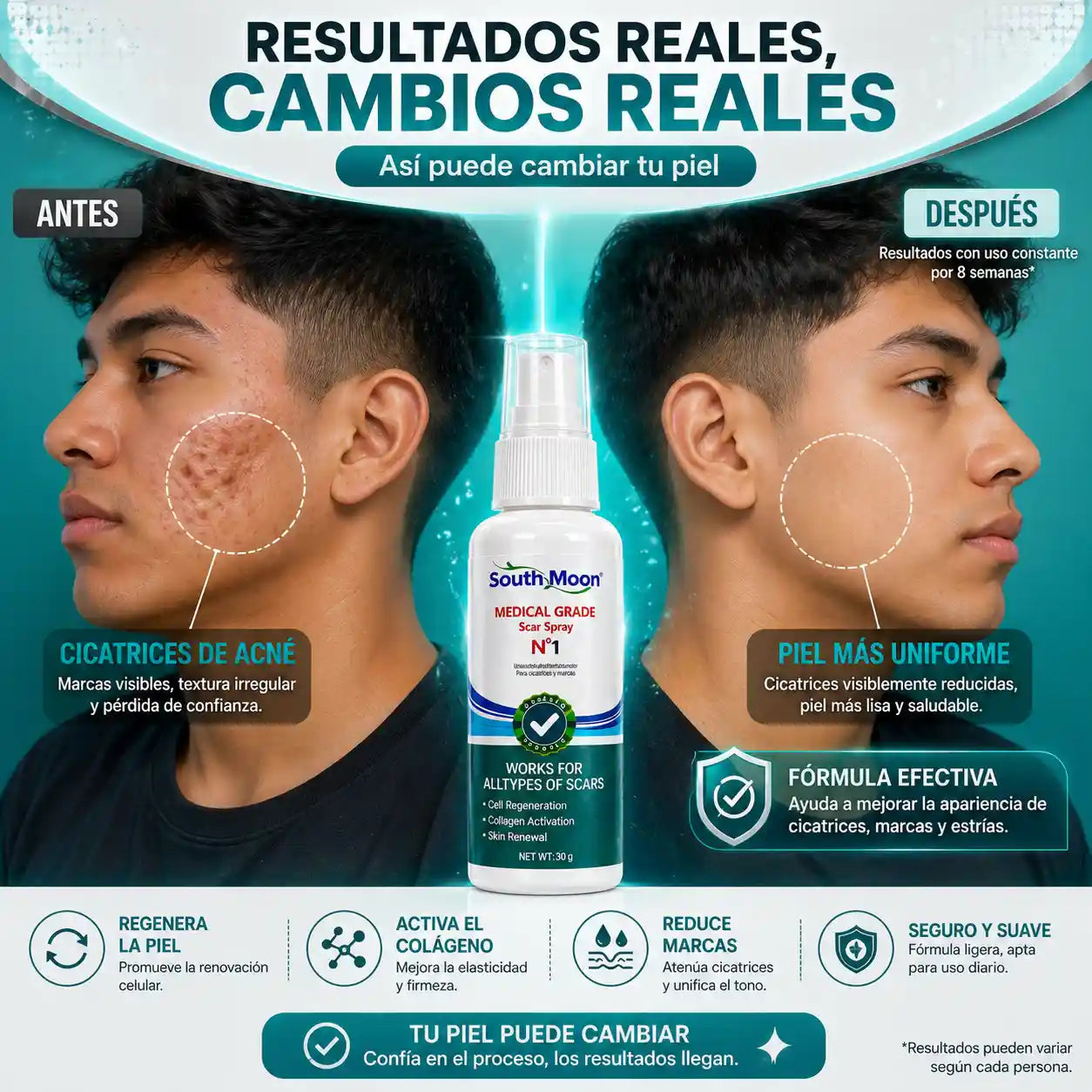 SOUTH MOON® - Spray para cicatrices
