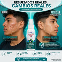 SOUTH MOON® - Spray para cicatrices
