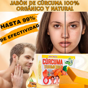 OFERTA 3X1  - JABÓN DE CÚRCUMA 100% NATURAL