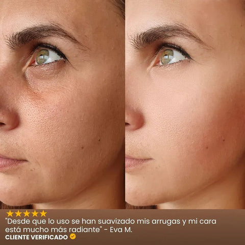 Image of INFIBELLA®️ - Reduce líneas de expresión y luce joven